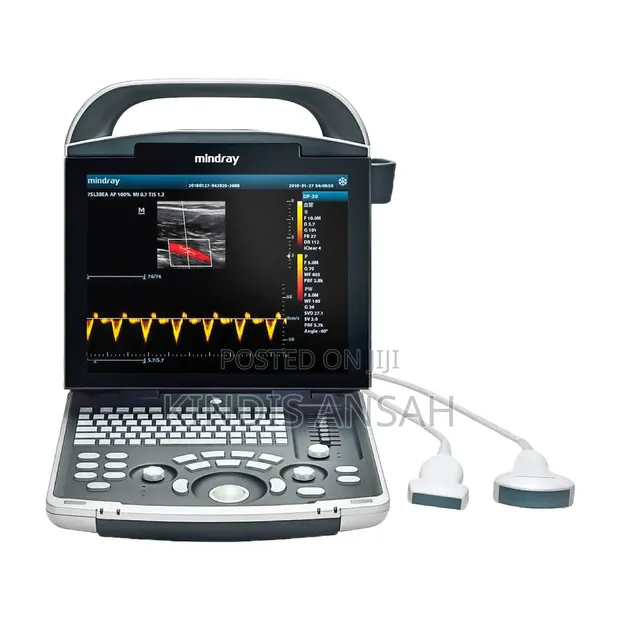 Mindray DP-10 Ultrasound - 1
