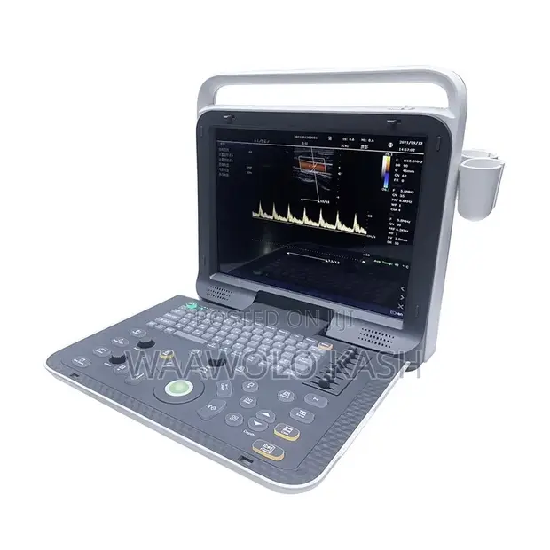 Portable Color Doppler Ultrasound System - E8 - 1