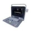 Portable Color Doppler Ultrasound System - E8 - 1