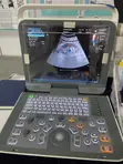Portable Color Doppler Ultrasound System - E8 - 5