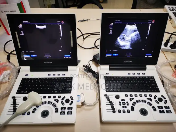 Brand New SonoTec Portable Ultrasound Scan Machine with Convex Probe - 1