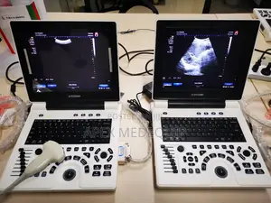 Brand New SonoTec Portable Ultrasound Scan Machine with Convex Probe