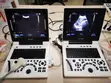 Brand New SonoTec Portable Ultrasound Scan Machine with Convex Probe - 1