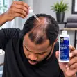 Member's Mark 5% Minoxidil Hair Regrowth Treatment for Men - 1