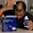 Member's Mark 5% Minoxidil Hair Regrowth Treatment for Men - 2