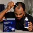 Member's Mark 5% Minoxidil Hair Regrowth Treatment for Men - 1