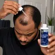Member's Mark 5% Minoxidil Hair Regrowth Treatment for Men - 2