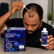 Member's Mark 5% Minoxidil Hair Regrowth Treatment for Men - 1