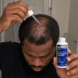 Member's Mark 5% Minoxidil Hair Regrowth Treatment for Men - 2