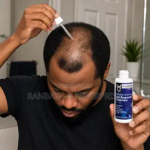 Member's Mark 5% Minoxidil Hair Regrowth Treatment for Men