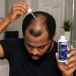 Member's Mark 5% Minoxidil Hair Regrowth Treatment for Men - 1