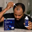 Member's Mark 5% Minoxidil Hair Regrowth Treatment for Men - 2