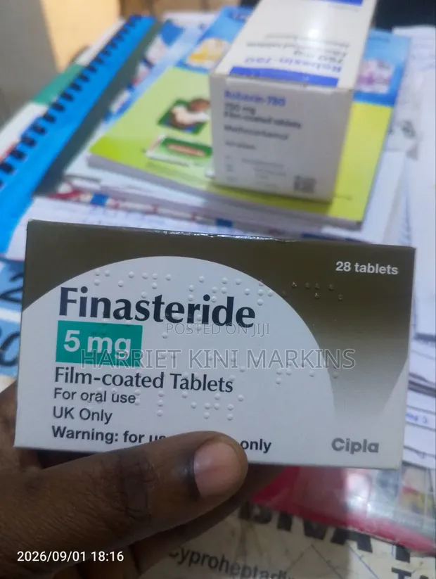 Finasteride 5mg Tablets - 1