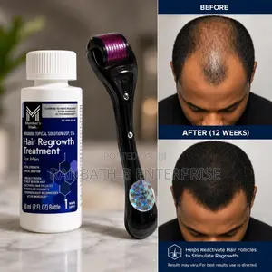 Member's Mark Minoxidil 5% Hair Regrowth Treatment + Derma Roller
