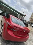 2015 Hyundai Elantra SE Sedan - 3