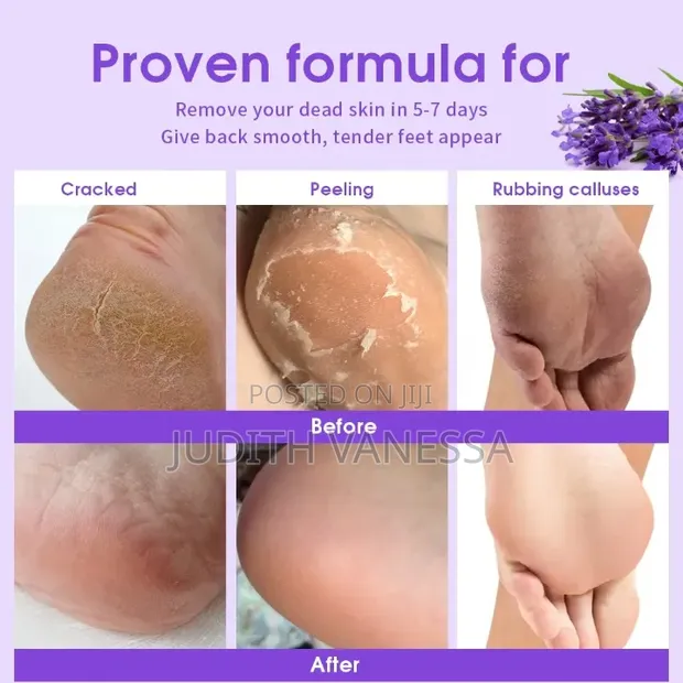 Foot Peel Exfoliating Foot Mask - 1