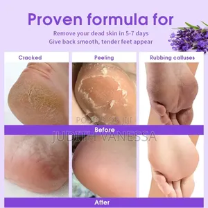 Foot Peel Exfoliating Foot Mask