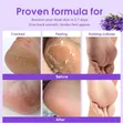 Foot Peel Exfoliating Foot Mask - 1