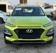 2018 Hyundai Kona - Push Start, Sunroof - 5