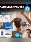 Kirkland Minoxidil 5% Topical Solution - 5