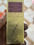TCM Scar Removal Cream - 1