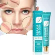 Scar Cream for Deep Repair - 1