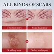 Scar Cream for Deep Repair - 4
