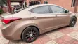 2015 Hyundai Elantra Limited Gold - 3