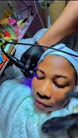 Anti Acne Facial Treatment - 3