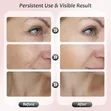 ES-1081 Intense Pulsed Light Wrinkles Reducing Instrument - 3