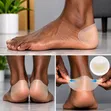 Self-Adhesive Heel Blister Patch - 5 Pairs - 1