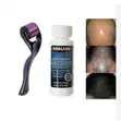 Kirkland Minoxidil Hair Regrowth Treatment - 1