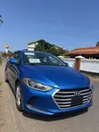 2017 Hyundai Elantra SE Sedan FWD - 3