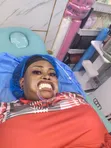 Professional Teeth Whitening Service - 5
