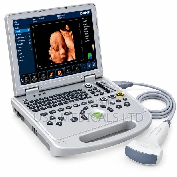 Brand New DAWEI Ultrasound Scan Trolley with Convex Probe - 1