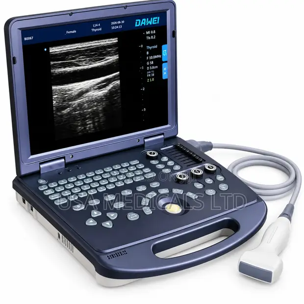 DAWEI Ultrasound Scan Trolley with Probe - 1