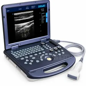 DAWEI Ultrasound Scan Trolley with Probe