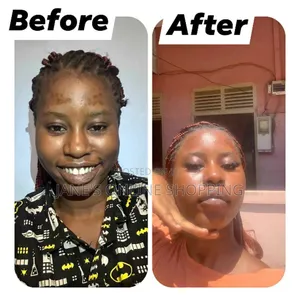 Skin Treatment Soap