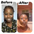 Skin Treatment Soap - 1