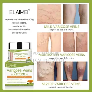 Varicose Veins Cream (Elemis)