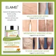 Varicose Veins Cream (Elemis) - 1