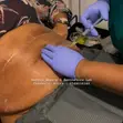 Fat Dissolving, Body Sculpting, Massage & Facials - 1