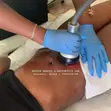 Fat Dissolving, Body Sculpting, Massage & Facials - 2