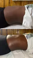 Fat Dissolving, Body Sculpting, Massage & Facials - 3