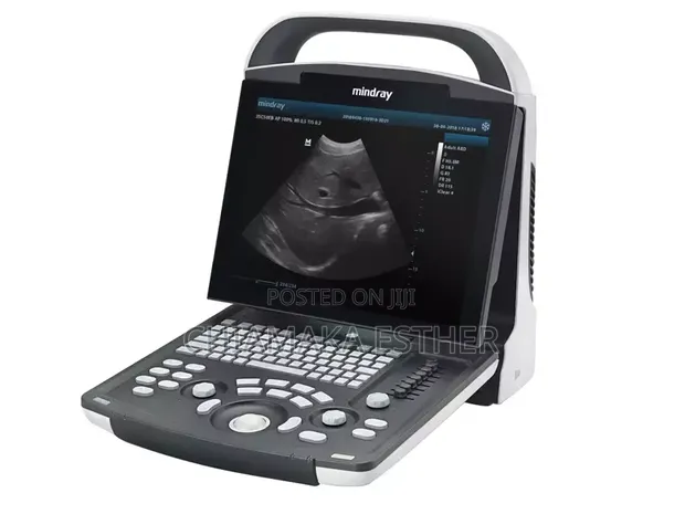 Mindray DP-10 Ultrasound System - 1
