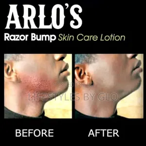 Arlo's Razor Bump Skin Care Lotion