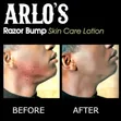 Arlo's Razor Bump Skin Care Lotion - 1