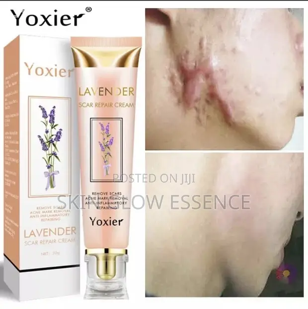 Yoxier Scar Remover Cream - 1