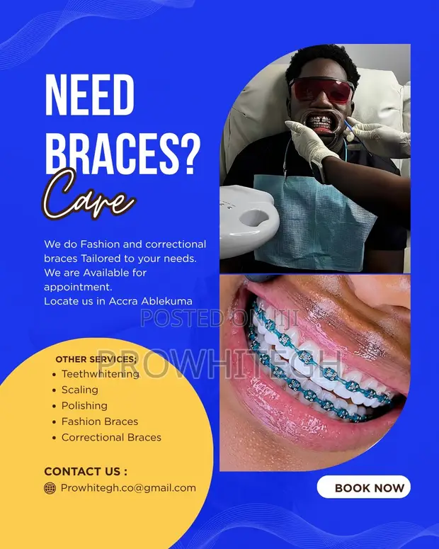 Fashion and Correctional Braces - 1