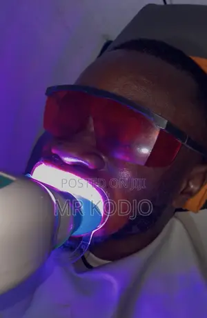 Teeth Whitening Service